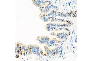 Immunohistochemistry of paraffin-embedded mouse lung using RGS5 antibody (ABIN6130676, ABIN6146924, ABIN6146925 and ABIN6222790) at dilution of 1:100 (40x lens). (RGS5 antibody  (AA 1-181))