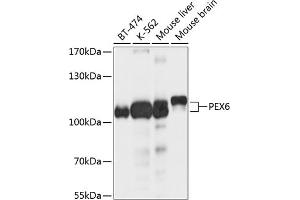 Western blot analysis of extracts of various cell lines, using PEX6 antibody (ABIN6133134, ABIN6145472, ABIN6145473 and ABIN6214721) at 1:1000 dilution. (PEX6 antibody  (AA 741-980))