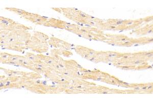 Detection of MSTN in Mouse Cardiac Muscle Tissue using Polyclonal Antibody to Myostatin (MSTN) (MSTN antibody  (AA 268-376))