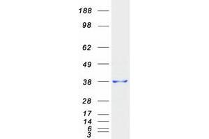 Validation with Western Blot