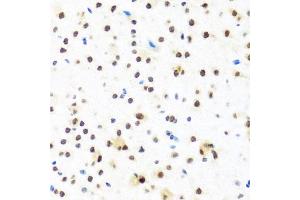 Immunohistochemistry of paraffin-embedded mouse brain using FUBP1 antibody. (FUBP1 antibody)