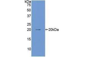 Detection of Recombinant ANGPT1, Mouse using Polyclonal Antibody to Angiopoietin 1 (ANGPT1) (Angiopoietin 1 antibody  (AA 253-429))