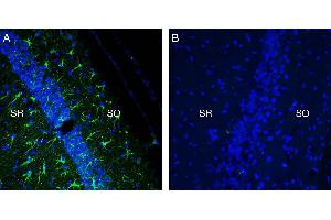 Expression of TREM2 in mouse hippocampus in a kainic acid neurodegeneration model. (TREM2 antibody  (Extracellular))