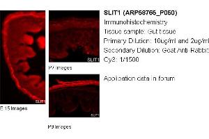 Image no. 1 for anti-Slit Homolog 1 (SLIT1) (Middle Region) antibody (ABIN504532) (SLIT1 antibody  (Middle Region))