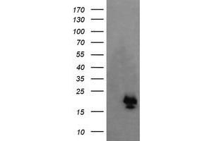 Image no. 1 for anti-NFKB Inhibitor Interacting Ras-Like 1 (NKIRAS1) antibody (ABIN1499742) (NKIRAS1 antibody)