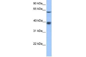 WB Suggested Anti-MFSD4 Antibody Titration: 0.