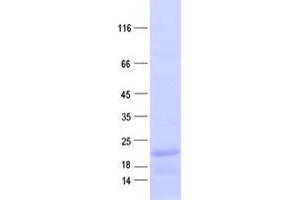 Transmembrane Protein 42 (TMEM42) protein (His tag)