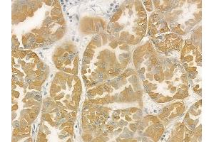 ABIN6258318 and ABIN6275481 at 1/100 staining human normal kidney tissue by IHC-P. (RGS5 antibody  (Internal Region))
