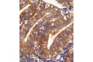 POSTN Antibody immunohistochemistry analysis in formalin fixed and paraffin embedded human uterus tissue followed by peroxidase conjugation of the secondary antibody and DAB staining. (Periostin antibody  (C-Term))