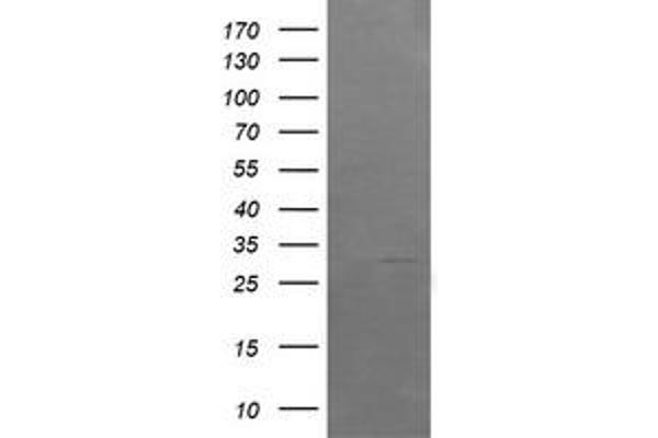 ARMC1 antibody