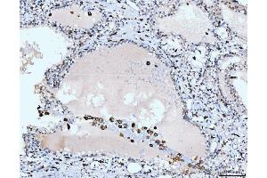 IHC analysis of CD163 using anti-CD163 antibody (ABIN5693082).