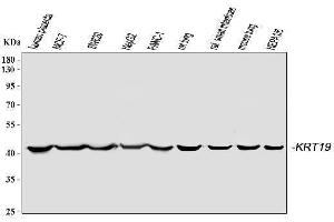 Western blot analysis of Cytokeratin 19 using anti-Cytokeratin 19 antibody (ABIN3043288). (Cytokeratin 19 antibody  (C-Term))