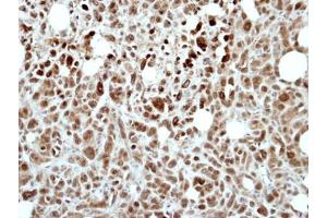 IHC-P Image Immunohistochemical analysis of paraffin-embedded PC9 xenograft, using RING1, antibody at 1:500 dilution. (RING1 antibody)