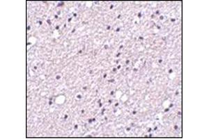 Immunohistochemistry of NK3R in human brain tissue with this product at 5 μg/ml.