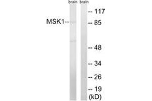 Western blot analysis of extracts from mouse brain cells, using MSK1 (Ab-212) Antibody. (MSK1 antibody  (AA 181-230))