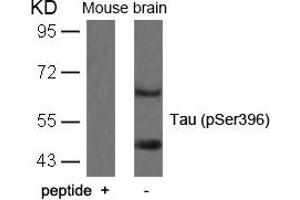 Western blot analysis of extracts from mouse brain tissue using Tau(Phospho-Ser396) Antibody and the same antibody preincubated with blocking peptide. (MAPT antibody  (pSer396))