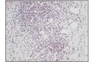 Image no. 1 for anti-Connective Tissue Growth Factor (CTGF) antibody (ABIN181699) (CTGF antibody)