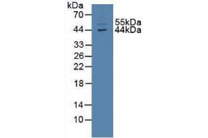Figure. (TXNIP antibody  (AA 30-381))