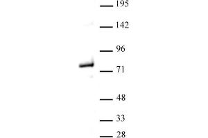 Western blot of Menin antibody. (Menin antibody  (C-Term))