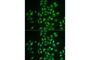 Immunofluorescence analysis of U2OS cells using LNX1 antibody (ABIN5973876). (LNX1 antibody)