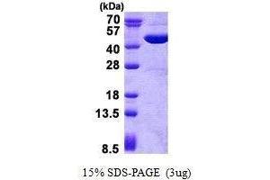 Figure annotation denotes ug of protein loaded and % gel used. (GOT2 Protein)