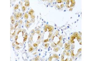 Immunohistochemistry of paraffin-embedded Human stomach using TDGF1 Polyclonal Antibody at dilution of 1:100 (40x lens). (TDGF1 antibody)