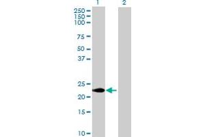 Western Blot analysis of CABP7 expression in transfected 293T cell line by CABP7 MaxPab polyclonal antibody.