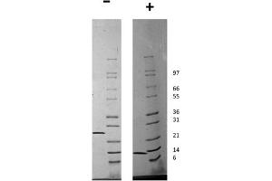 SDS-PAGE of Human Artemin Recombinant Protein SDS-PAGE of Human Artemin Recombinant Protein. (ARTN Protein)
