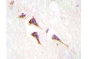 Immunohistochemistry analyzes of mTOR antibody in paraffin-embedded human brain tissue. (MTOR antibody)