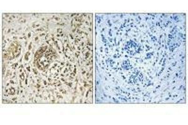 CIB2 antibody