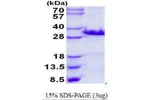 Image no. 1 for Galectin 3 (LGALS3) protein (His tag) (ABIN1098459)