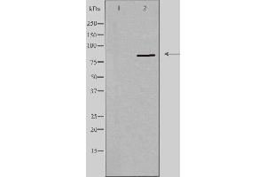 Western blot analysis of extracts from HeLa cells using PNPLA8 antibody. (PNPLA8 antibody  (C-Term))