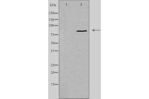 PNPLA8 抗体  (C-Term)