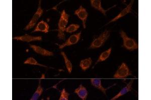 Immunofluorescence analysis of L929 cells using RPL24 Polyclonal Antibody at dilution of 1:100 (40x lens).