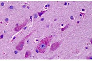 Human Brain, Cortex: Formalin-Fixed, Paraffin-Embedded (FFPE) (CXCR7 antibody  (AA 311-360))