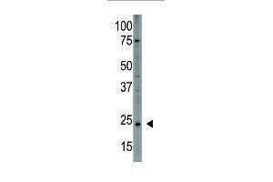 The anti-PDGFA (N-term) (ABIN388459 and ABIN2848847) is used in Western blot to detect PDGFA in HL60 cell lysate. (PDGFA antibody  (N-Term))