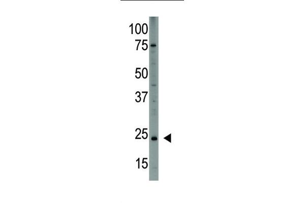 PDGFA antibody  (N-Term)