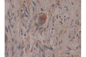Immunohistochemistry (IHC) image for anti-Cytochrome C Oxidase Subunit II (COX2) (AA 187-425) antibody (ABIN7432421)