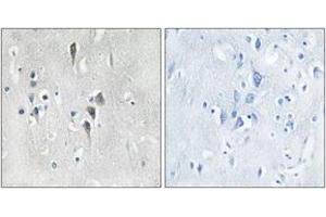 Immunohistochemistry analysis of paraffin-embedded human brain tissue, using CaMK2 alpha/delta (Ab-286) Antibody. (CaMK2 alpha/delta antibody  (AA 256-305))