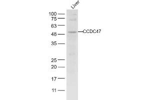 Mouse liver lysates probed with CCDC47 Polyclonal Antibody, unconjugated  at 1:1000 overnight at 4°C followed by a conjugated secondary antibody for 60 minutes at 37°C. (CCDC47 antibody  (AA 375-483))