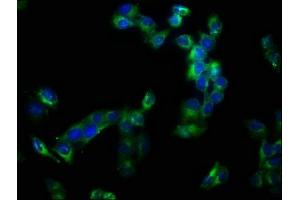 Immunofluorescence staining of Hela cells with ABIN7150034 at 1:133, counter-stained with DAPI. (A Disintegrin and Metallopeptidase Domain 1a (ADAM1A) (AA 214-504) antibody)