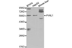 Western blot analysis of extracts of various cell lines, using PVRL1 antibody (ABIN5971069) at 1/1000 dilution. (PVRL1 antibody)