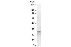 Western blot testing of human cerebellum lysate with OTUB2 antibody at 1ug/ml. (OTUB2 antibody)