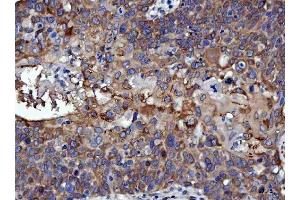 IHC analysis of RRS1 using anti-RRS1 antibody (ABIN7602918). (RRS1 antibody  (C-Term))