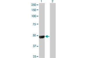 Western Blot analysis of UBR2 expression in transfected 293T cell line by UBR2 monoclonal antibody (M01), clone 4G4. (UBR2 antibody  (AA 1-100))