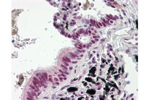 Image no. 1 for anti-DnaJ (Hsp40) Homolog, Subfamily C, Member 3 (DNAJC3) (AA 270-462) antibody (ABIN467547) (DNAJC3 antibody  (AA 270-462))