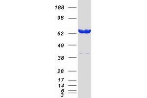 Validation with Western Blot