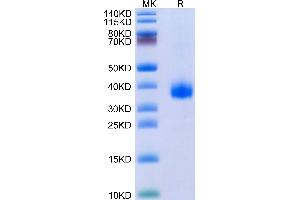 SARS-Cov-2 Spike RBD(B. (SARS-CoV-2 Spike Protein (B.1.640, RBD) (His tag))