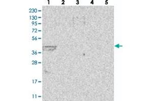 Western blot analysis of Lane 1: RT-4, Lane 2: U-251 MG, Lane 3: Human Plasma, Lane 4: Liver, Lane 5: Tonsil with LIPT1 polyclonal antibody . (LIPT1 antibody)