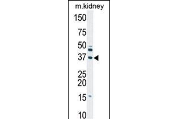 Deoxyguanosine Kinase antibody  (N-Term)